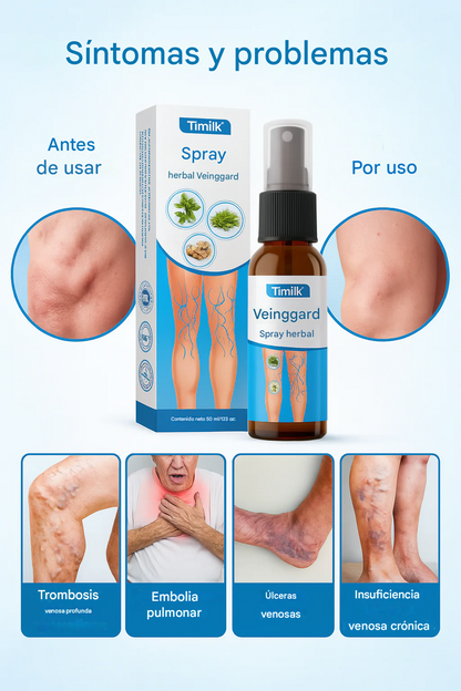 Timilk® VeinGuard, 99.9% Eliminando las varices desde casa + 🎁