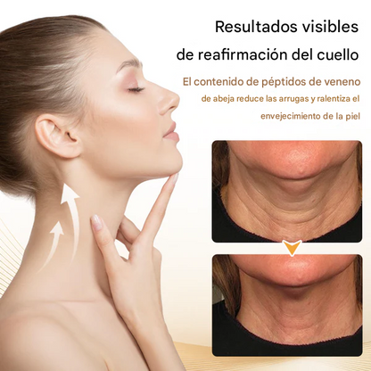 Biancat® Barra reafirmante para el cuello