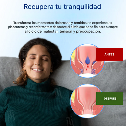 Crema para hemorroides y fisuras Cvreoz®