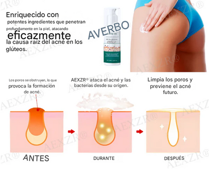 Crema para el tratamiento de glúteos AEXZR®