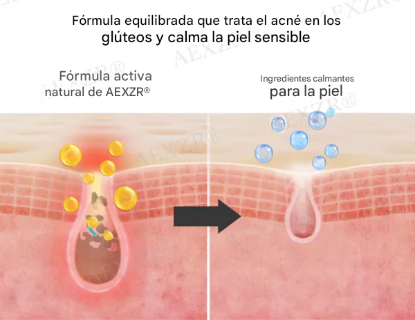 Crema para el tratamiento de glúteos AEXZR®
