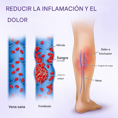 Crema fito Timilk® VeinRelief