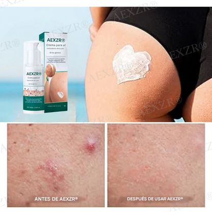 Crema para el tratamiento de glúteos AEXZR®