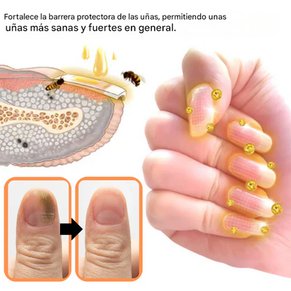 AEXZR® Spray de tratamiento reparador de uñas con veneno de abeja