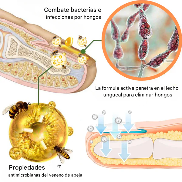 AEXZR® Spray de tratamiento reparador de uñas con veneno de abeja
