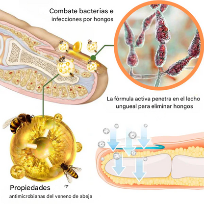 AEXZR® Spray de tratamiento reparador de uñas con veneno de abeja