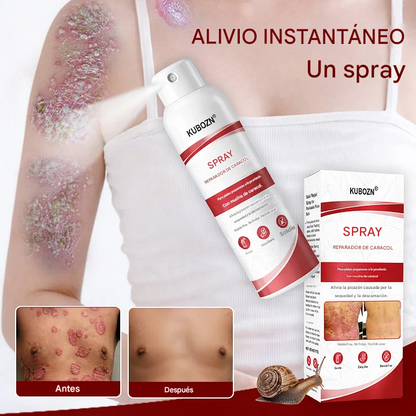KUBOZN® Spray reparador de caracol para piel con psoriasis, con picazón y descamación.