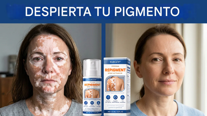 Spray Activador de Repigmento con Piperina para Reactivar las Células Pigmentarias Latentes y Restaurar el Color Natural de la Piel