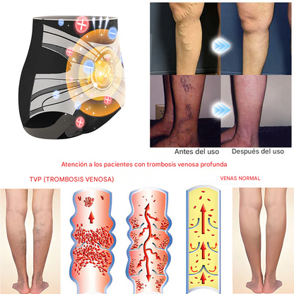 Oferta relámpago 2025🔥: Shorts moldeadores Anyidea® de fibra de titanio y turmalina de grado médico (¡Último día: 80 % de descuento! 🚨)